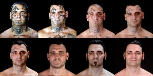 $Tattoo Removal.jpg