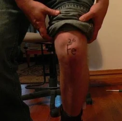 iron knee.webp