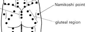 $gluteal region points.jpg